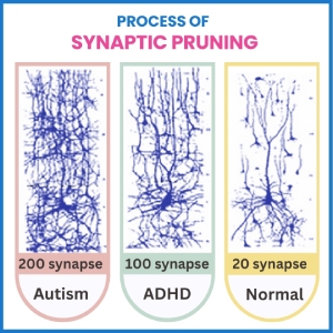 Process of synaptic pruning IN AUTISM,ADHD and Normal